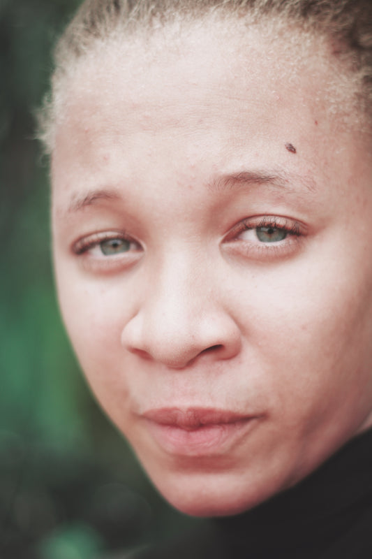 Vitamins For Alopecia